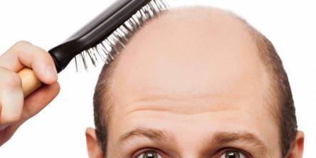 Who Are the Best Candidates for PRP Treatment? 